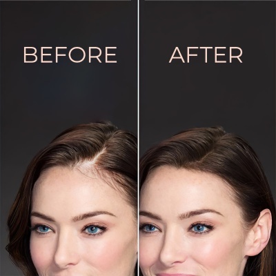 Rosto de mulher com cabelo castanho e olhos azuis, comparando BEFORE e AFTER.