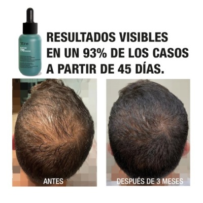 Tahe Programa profissional anti queda: Concentrado 50 ml + Champô Peptídeo T98