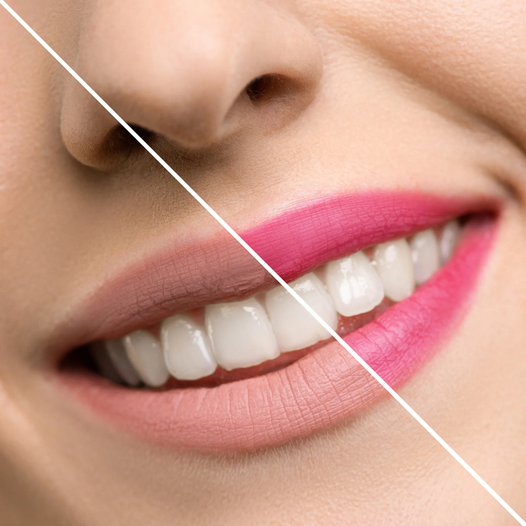 Close-up da boca sorridente com batom rosa em dois tons diferentes, divididos por linha diagonal branca