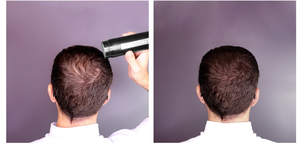 Homem a aplicar spray capilar preto na cabeça vista de trás