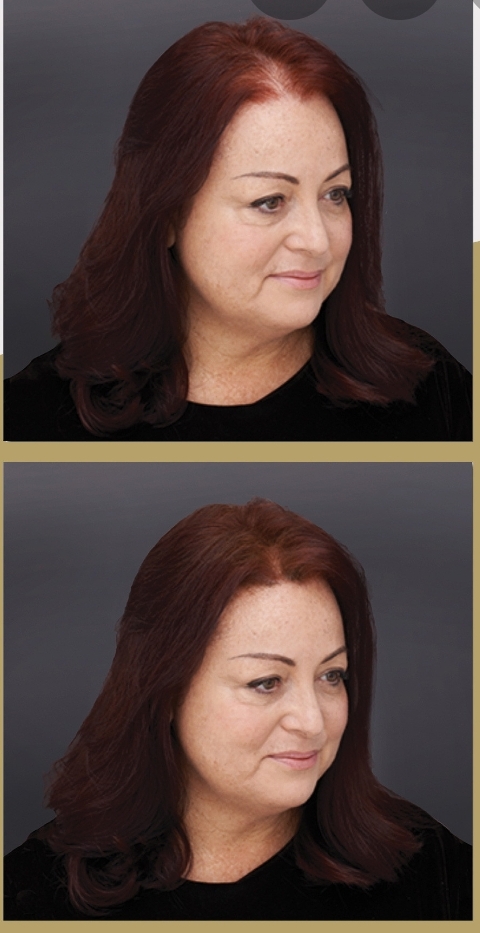 Mulher com cabelo castanho-avermelhado e camisola preta sobre fundo cinzento