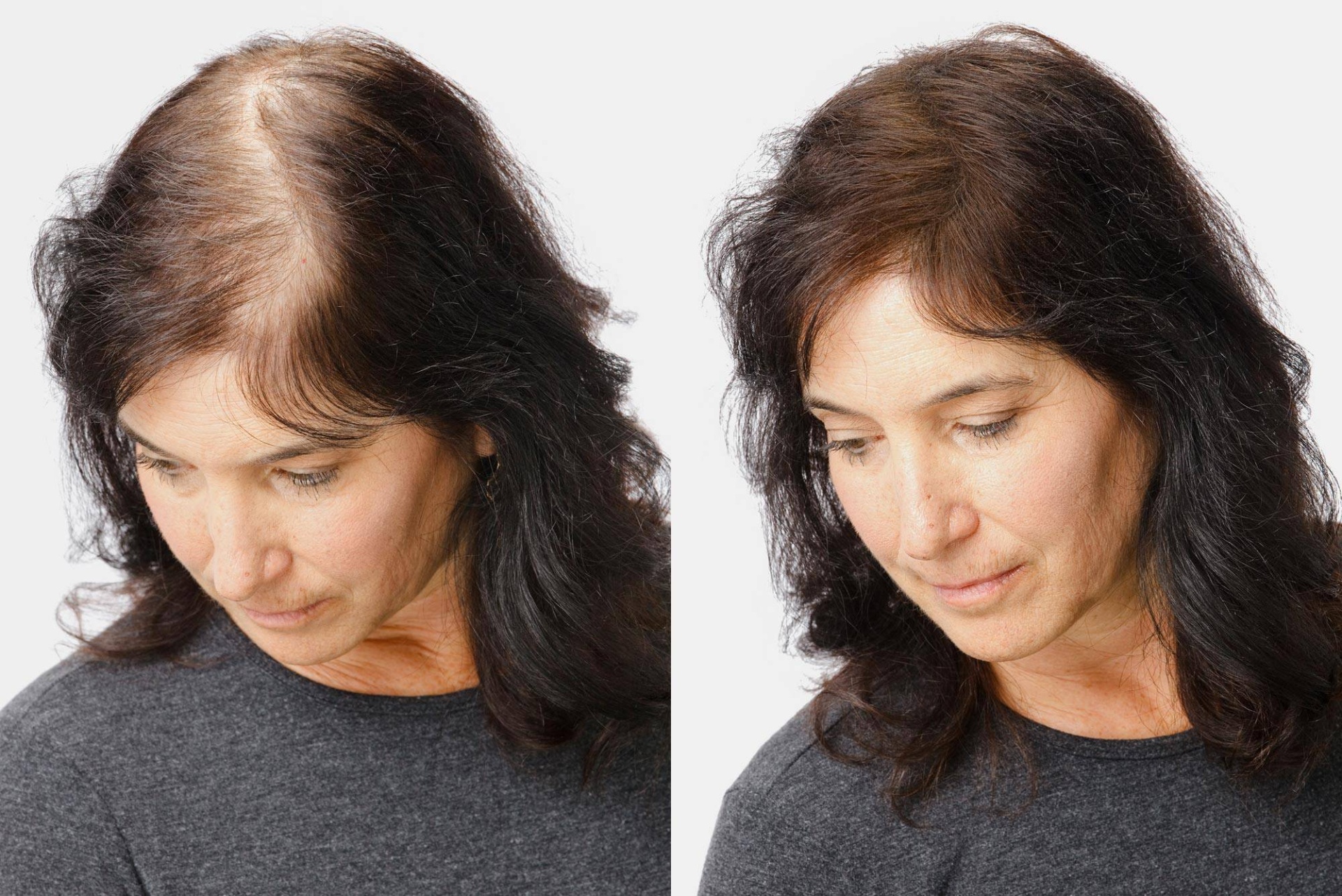 Mulher com cabelo castanho escuro e camisola cinzenta, antes e depois de aumento de volume do cabelo