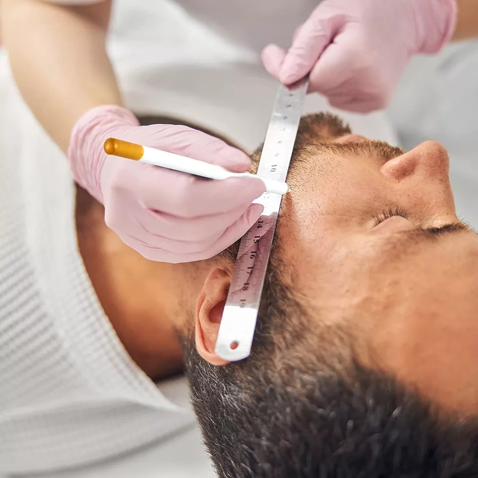 Pessoa fazendo marcação na testa de homem com régua e caneta