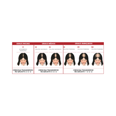 Quadro com diferentes estágios de calvície feminina e produtos Crescina Transdermic Re-Growth associados.