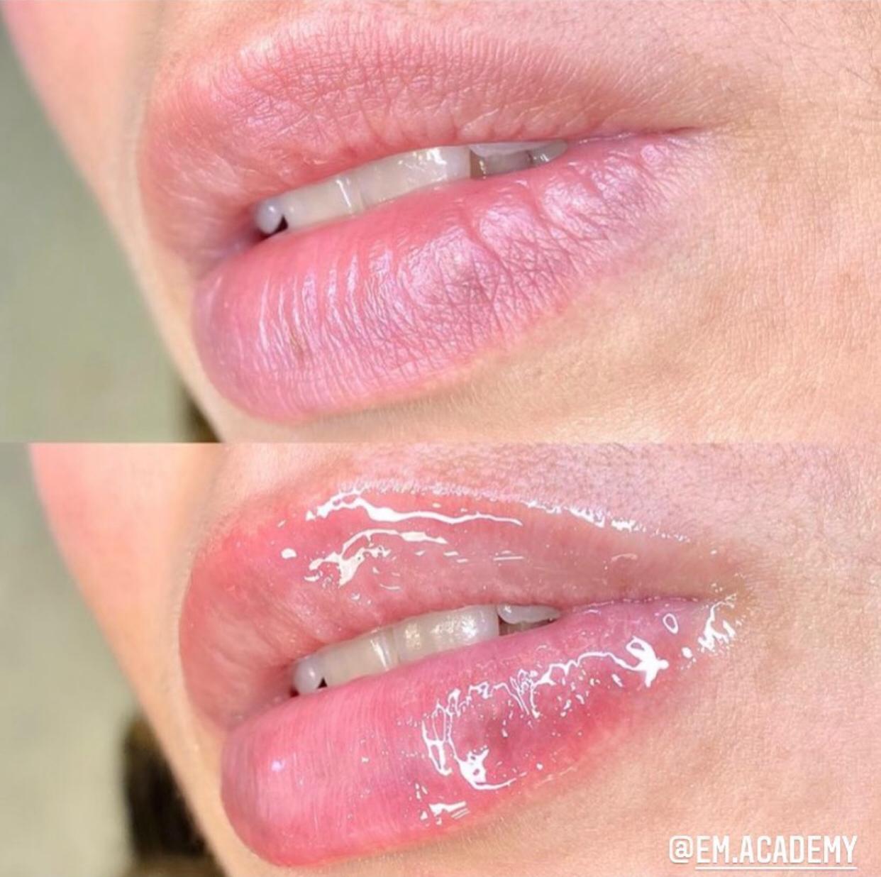 Hidragloss Lips protocolo profissional de hidrata&ccedil;&atilde;o labial lip hydration treatment nano infusion lips