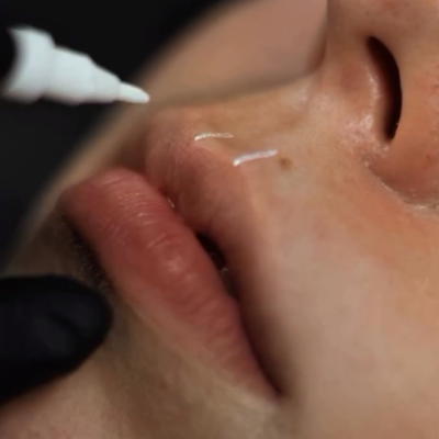 Aplicação de produto transparente perto dos lábios num rosto com pele clara