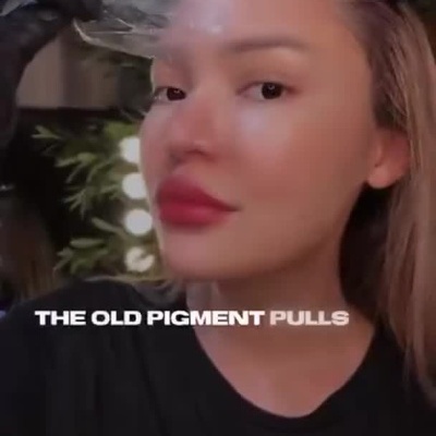 Mulher fazendo tratamento facial para remoção de pigmento antigo nas sobrancelhas