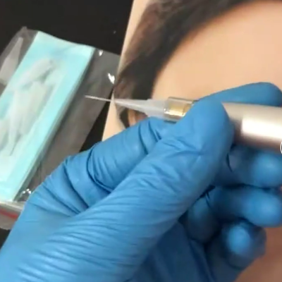 Mão com luva azul segurando caneta de micropigmentação junto ao rosto de mulher, máscara azul ao fundo