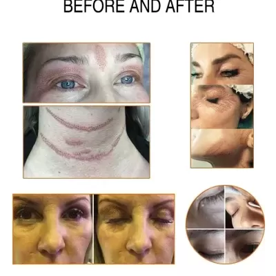 Fotografias de antes e depois de procedimentos estéticos faciais com marcas na pele.