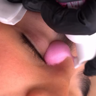 Pessoa com aplicação de produto cor de rosa na pálpebra fechada por mão com luva preta