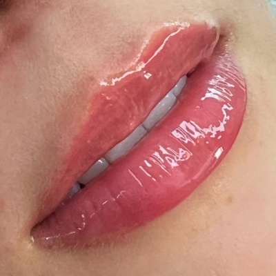 Lábios femininos com gloss labial rosa brilhante