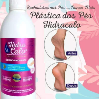 Frasco do produto Hidra Calo com fotos de pés rachados antes e depois do tratamento
