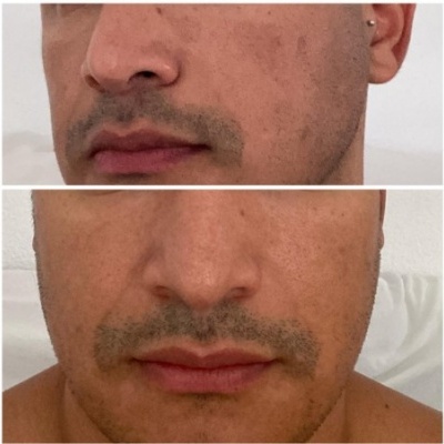 Close-up de rosto masculino com sombra de barba