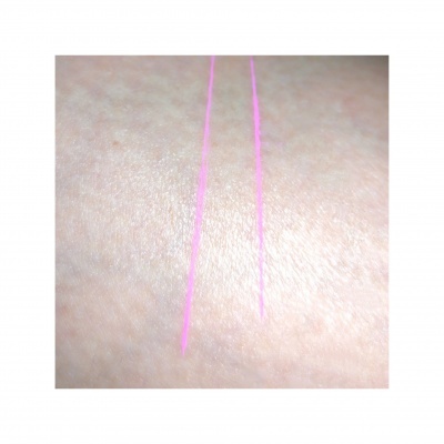 Pele com duas linhas rosas fluorescentes paralelas
