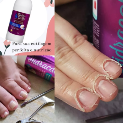 Produto Hidra Calo para cutículas com unhas tratadas e ferramentas de manicure