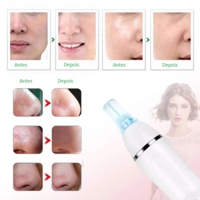 Dispositivo elétrico para cuidados faciais com imagens antes e depois de uso