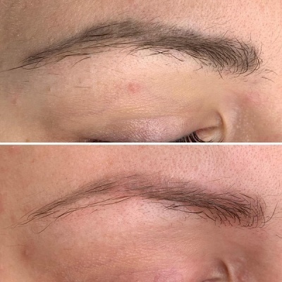 Duas sobrancelhas castanhas em pele clara, uma acima da outra.