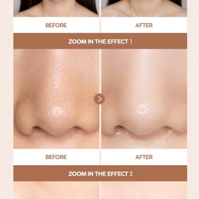 Antes e depois do uso de produto de pele, mostrando melhora na textura e uniformidade da pele do rosto