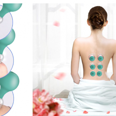 Conjunto de copos de ventosa verdes aplicados nas costas da mulher