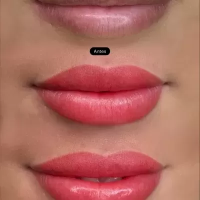 Três imagens de lábios femininos antes e depois de procedimento de pigmentação