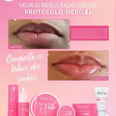 Imagens antes e depois de lábios tratados com produtos Bel Col com embalagens rosas e texto branco sobre fundo rosa.