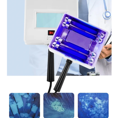 Aparelho de lâmpadas UV azuis para diagnóstico médico e imagens de pele e unhas sob luz UV
