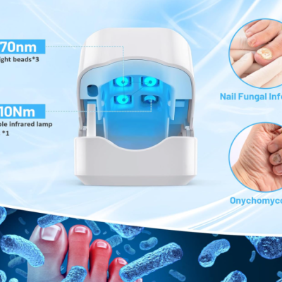 Aparelho branco para tratamento de unhas com luz azul e infravermelha para infeções fúngicas