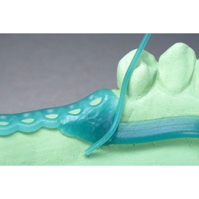 Modelo dentário com prótese flexível azul translucida