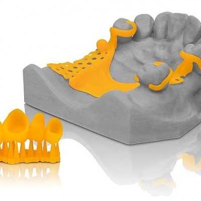 Modelo dentário com prótese dentária amarela e conjunto destacado ao lado