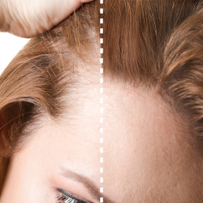 Perfect&#x20;Beauty&#x20;-&#x20;Fibras&#x20;capilares&#x20;Preto