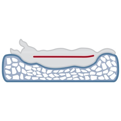 Esquema de colchão azul com corpo deitado cinza e linha vermelha