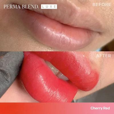 Lábios com pigmentação vermelho cereja antes e depois