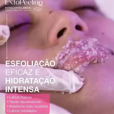 Pessoa recebendo esfoliação labial rosa com produto ExfoPeeling Tutti-Frutti