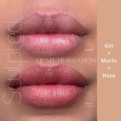 Antes e depois da neutralização labial com close-ups dos lábios em tons rosados