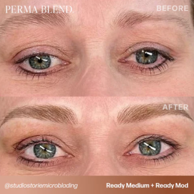 Imagem de antes e depois de sobrancelhas preenchidas com técnica de microblading