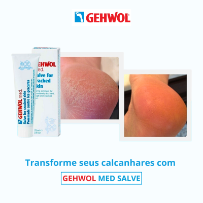 Produto GEHWOL MED SALVE com imagens de calcanhares antes e depois do uso