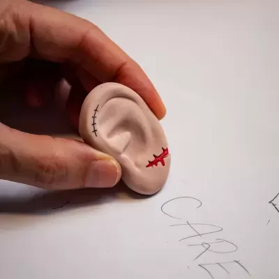 Modelo de orelha humana com cicatrizes em fundo branco com texto CARE