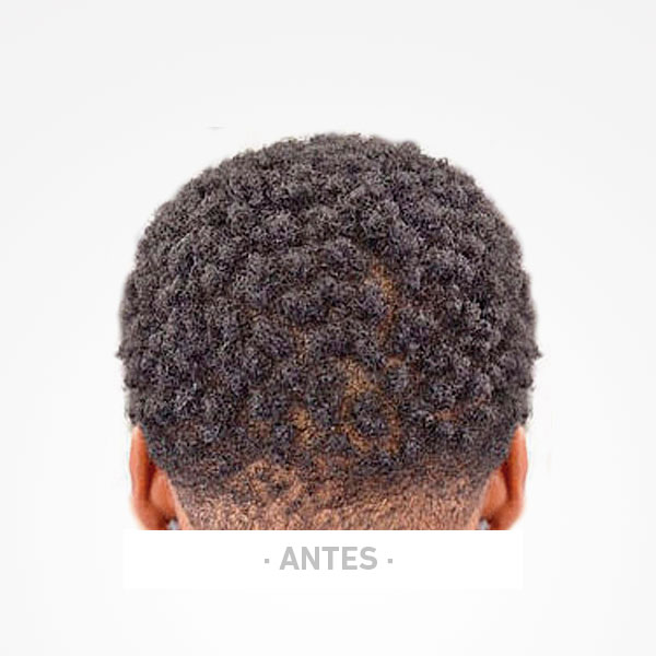 Parte de trás da cabeça com cabelo curto e encaracolado preto