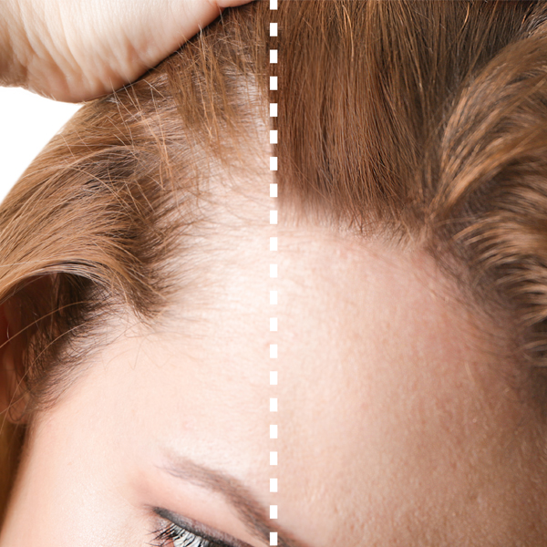 Close-up de testa e cabelo castanho com linha pontilhada branca a separar ao meio