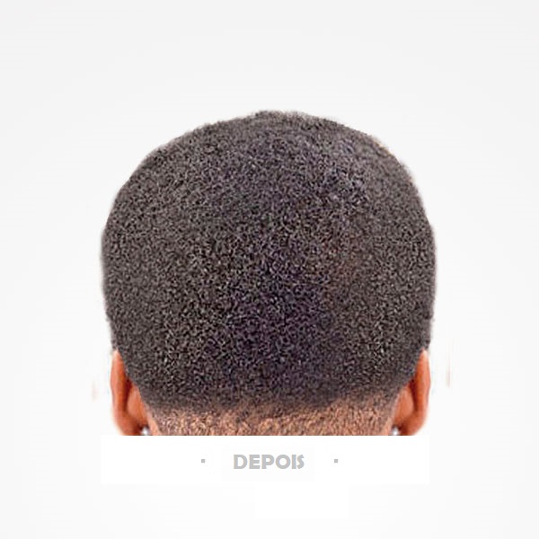 Cabelo curto e texturizado visto por trás com texto DEPOIS