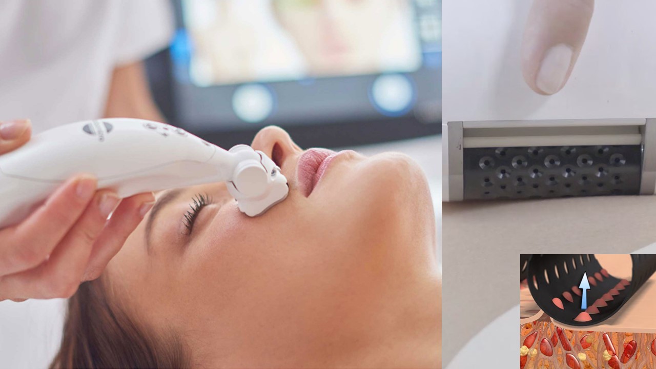 ICOONE® Facial - Tratamento base (30 min) Dispositivo branco aplicado no rosto de uma pessoa para tratamento facial.