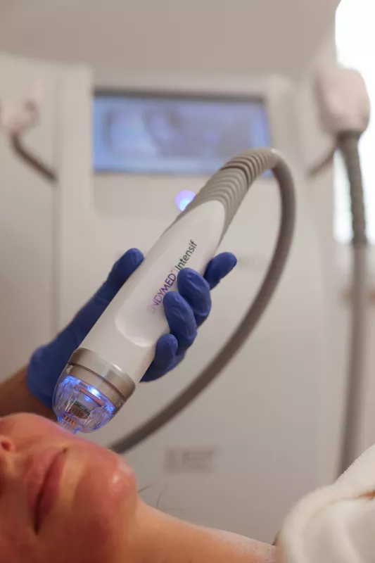 Rádiofrequência Endymed Rosto (40 min) Dispositivo estético branco com luz azul em uso no rosto de mulher numa clínica