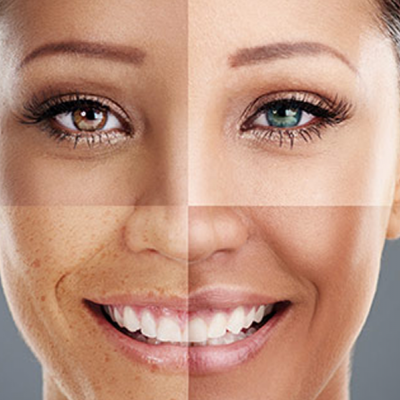 Rosto feminino dividido mostrando diferentes condições da pele