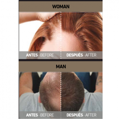 Comparação antes e depois de tratamento capilar para mulher e homem com texto em inglês e espanhol