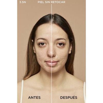 Rosto de mulher dividido em duas metades mostrando diferença na pele com texto ANTES e DESPUÉS