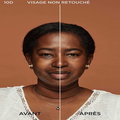 Rosto dividido ao meio de uma mulher negra mostrando antes e depois com diferenças na textura da pele