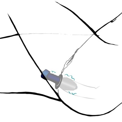 Ilustração de um cigarro aceso com fumo numa superfície branca com linhas pretas