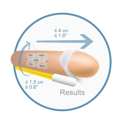 Faixas adesivas transparentes na pele com medidas e texto 'Results'