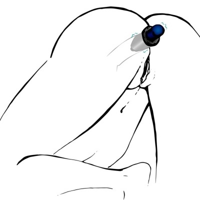 Desenho minimalista de figura humana com tubo azul e preto na região glútea