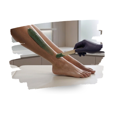 A aplicação de cera depilatória verde na perna de uma pessoa com luva preta.